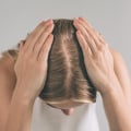 Diagnosing Female Hair Loss: Everything You Need to Know