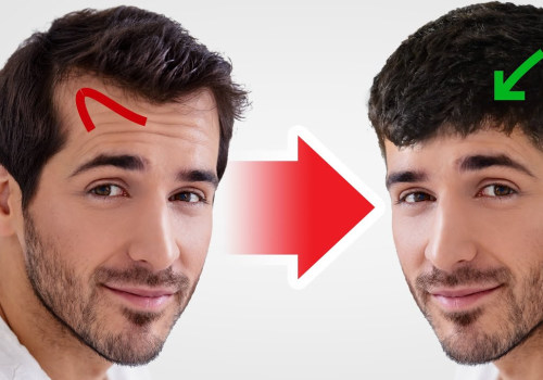 Hairstyles for Thinning Hair: Tips and Tricks for Men