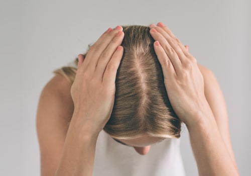 Diagnosing Female Hair Loss: Everything You Need to Know