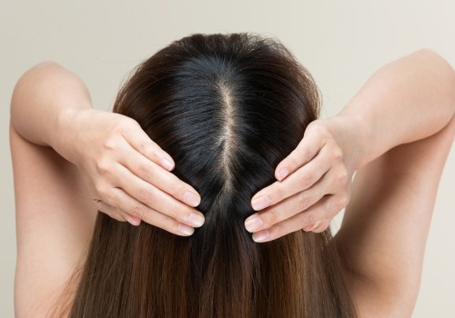 Lifestyle Changes for Preventing Female Hair Loss